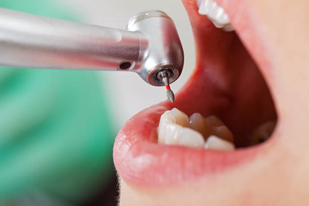 Best Dentist for Tooth Abscess  in Sho Creek, AL